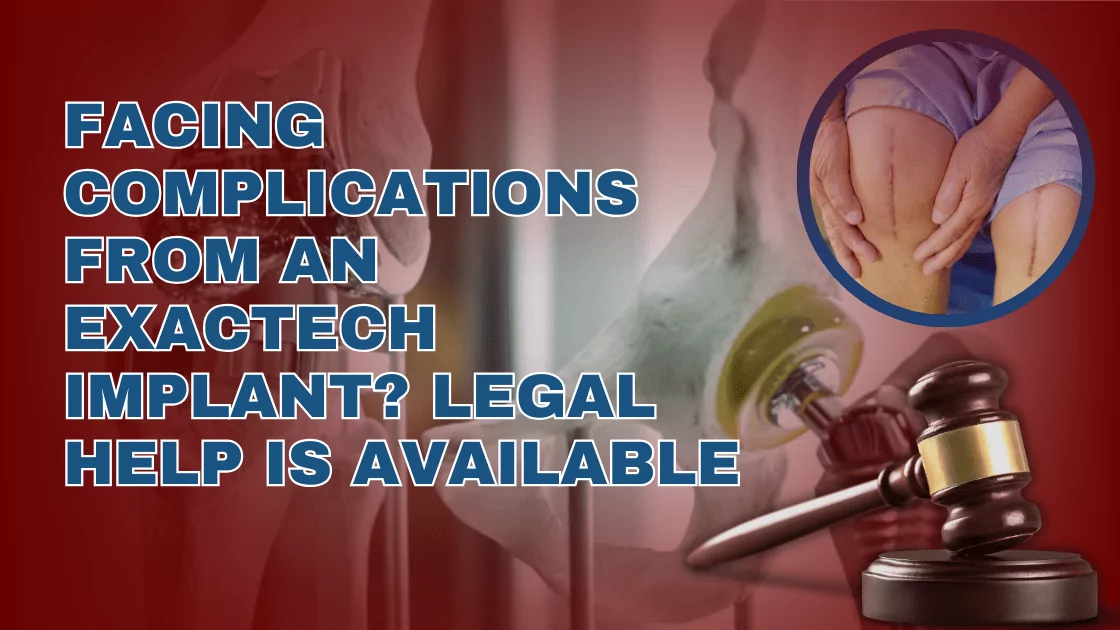 Facing Complications from An Exactech Implant? Legal Help is Available